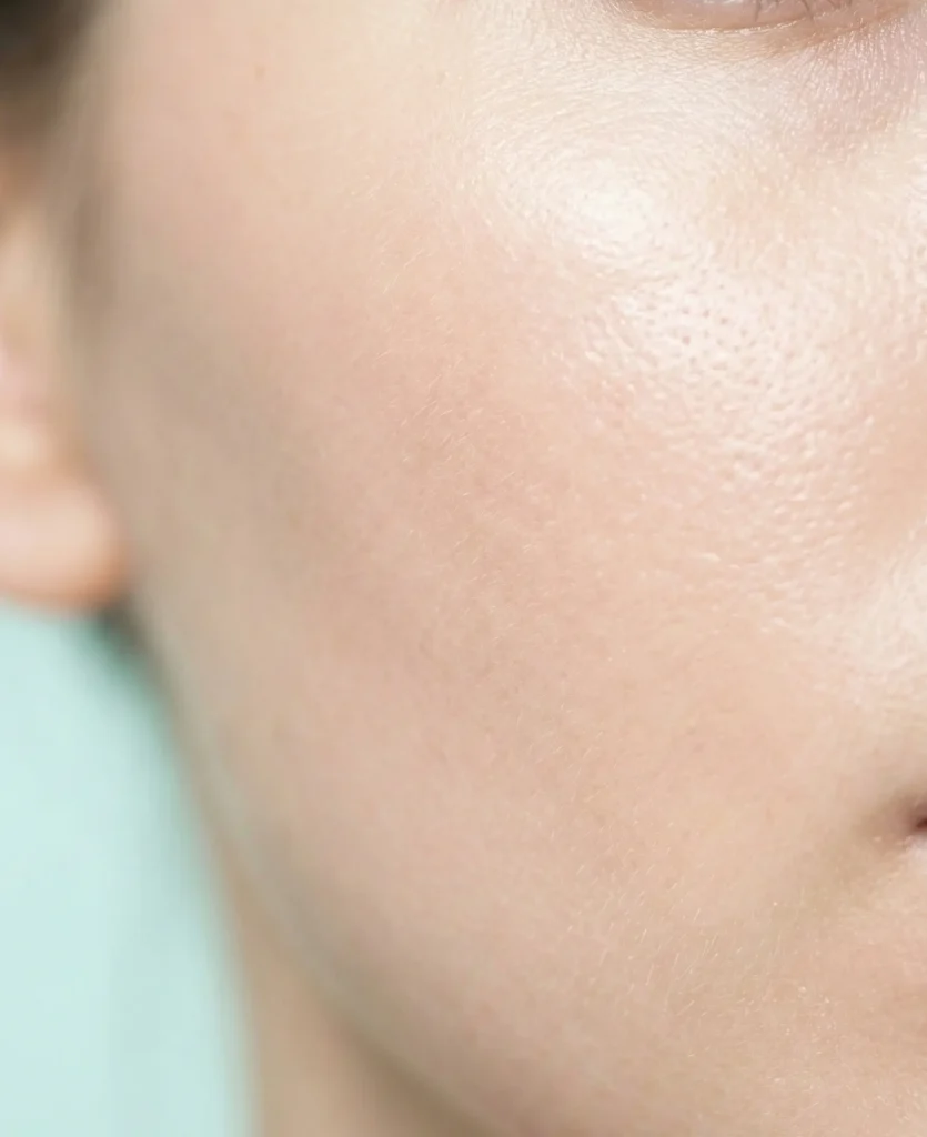 Tractament facial a Sant Cugat clínica Mimat